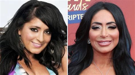 angelina pivarnick acne|Jersey Shore: Angelina admits to editing, filtering pictures, surgery